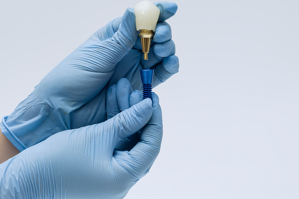 Dental implants dentist single tooth replacement procedure at Napa Dental Woodbridge showing implant and crown